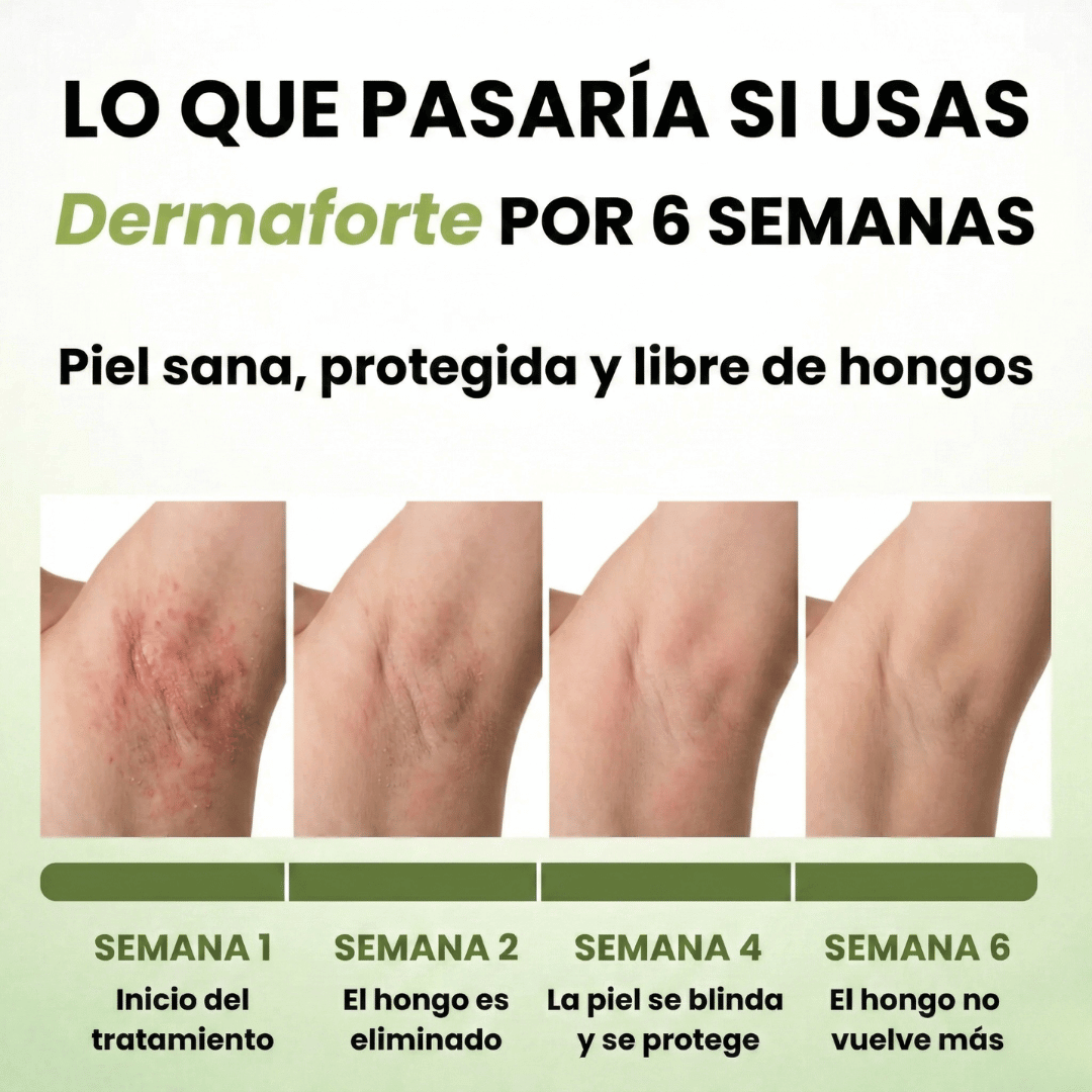 DermaForte: Erradica hongos y alivia la picazón severa