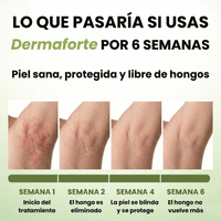 DermaForte: Erradica hongos y alivia la picazón severa